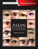 Asian Blepharoplasty and the Eyelid Crease, 3rd ed.