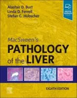 MacSween&#039;s Pathology of the Liver, 8th ed cover
