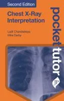  Pocket Tutor Chest X-Ray Interpretation cover