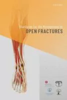 Standards for the management of open fractures cover